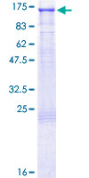 12.5% SDS-PAGE Stained with Coomassie Blue.